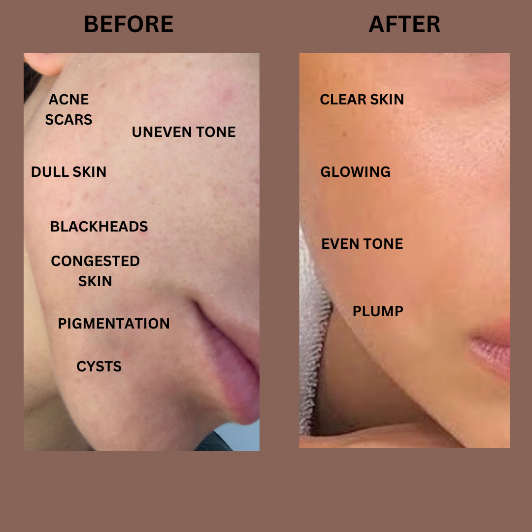 One Kit. All Skin. Real Results.