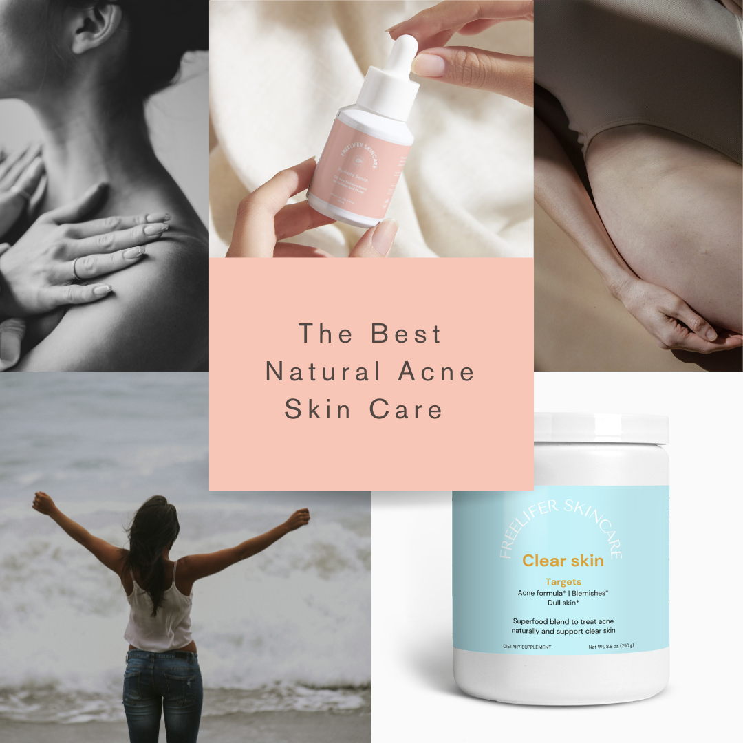 Why Switching to Natural Skincare Is the Best Solution for Acne