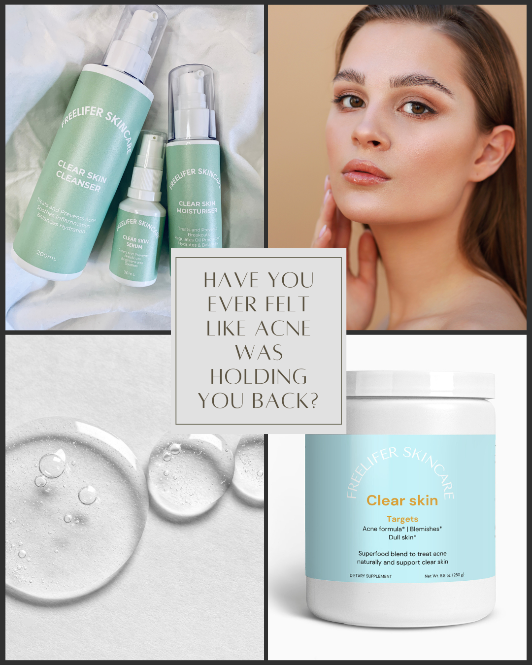 Have you ever felt like acne was holding you back?